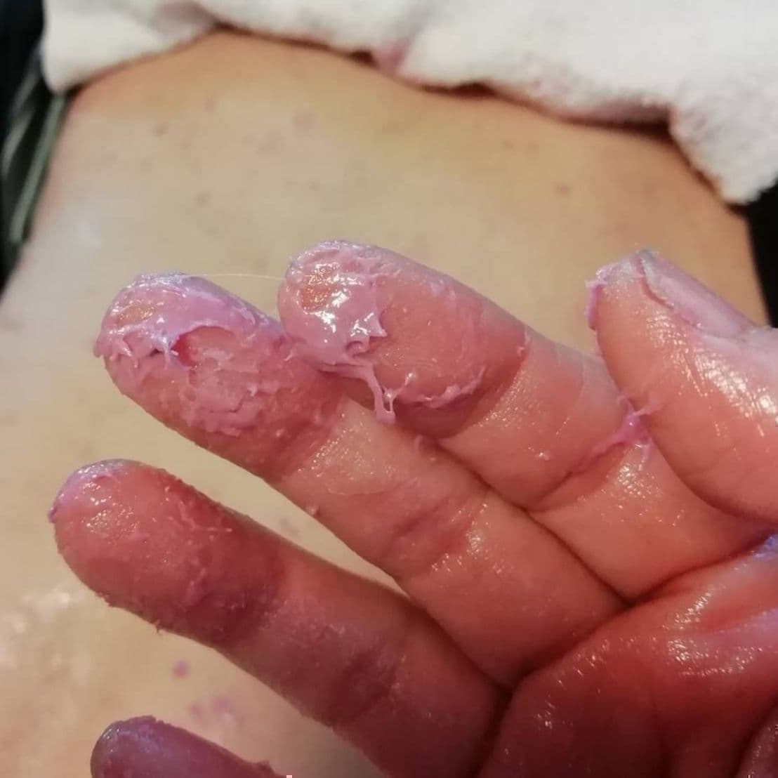 酵素パッティング